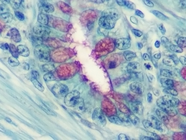 Simple Columnar Epithelium Slides - Simple Columnar Epithelium 22 400X
